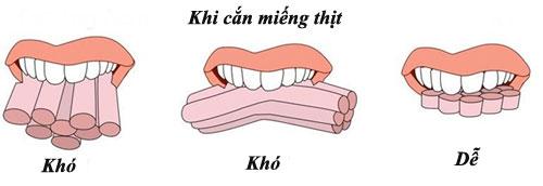 Cách thái thịt cho bạn thiếu kinh nghiệm